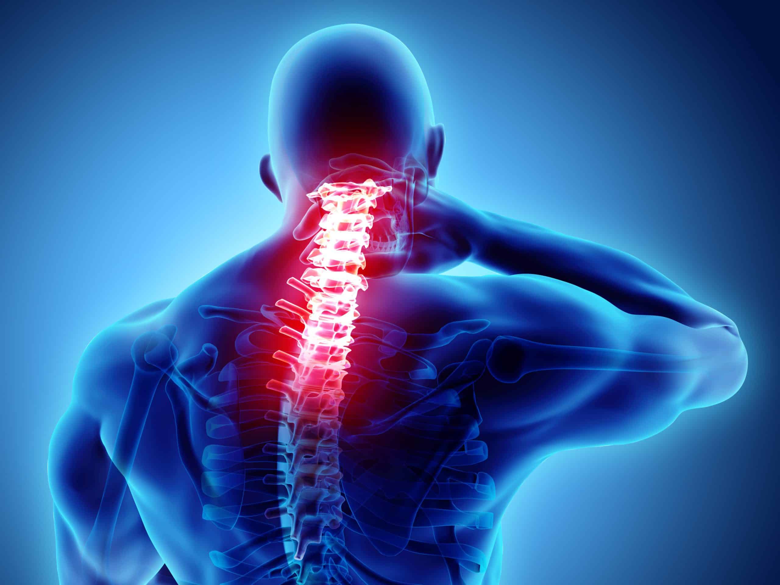 Neck Injury - Chronic Pain After Car Accident